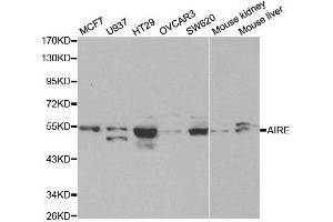 Western blot analysis of extracts of various cell lines, using AIRE antibody. (AIRE antibody  (AA 30-130))