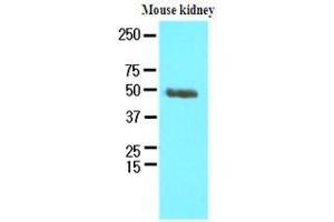 The extracts of mouse kidney (60 ug) were resolved by SDS-PAGE, transferred to nitrocellulose membrane and probed with anti-human PSMD11 (1:250). (PSMD11 antibody  (AA 1-422))