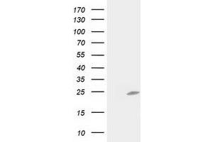 HEK293T cells were transfected with the pCMV6-ENTRY control (Left lane) or pCMV6-ENTRY C1orf50 (Right lane) cDNA for 48 hrs and lysed. (C1ORF50 antibody)