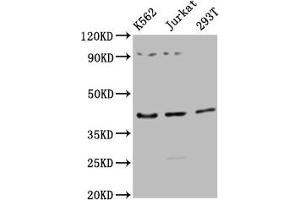 Western Blot Positive WB detected in: K562 whole cell lysate, Jurkat whole cell lysate, 293T whole cell lysate All lanes: ADIPOR1 antibody at 1:2500 Secondary Goat polyclonal to rabbit IgG at 1/50000 dilution Predicted band size: 43 kDa Observed band size: 43 kDa (Adiponectin Receptor 1 antibody  (AA 1-63))
