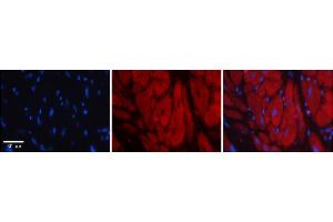 Rabbit Anti-KHSRP Antibody    Formalin Fixed Paraffin Embedded Tissue: Human Adult heart  Observed Staining: Cytoplasmic Primary Antibody Concentration: 1:100 Secondary Antibody: Donkey anti-Rabbit-Cy2/3 Secondary Antibody Concentration: 1:200 Magnification: 20X Exposure Time: 0.