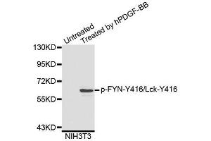Western blot analysis of extracts of NIH3T3 cells, using Phospho-FYN-Y416/Lck-Y416 antibody (ABIN5995595). (FYN antibody  (pTyr416))