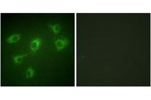 Immunofluorescence analysis of HuvEc cells, using TGF beta Receptor III Antibody. (TGFBR3 antibody  (AA 111-160))