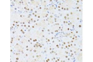 Immunohistochemistry of paraffin-embedded Rat pancreas using ETV1 Polyclonal Antibody at dilution of 1:100 (40x lens).