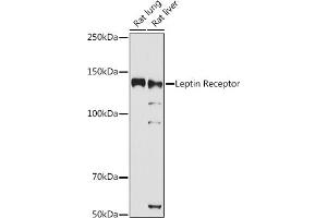 Western blot analysis of extracts of various cell lines, using Leptin Receptor antibody (ABIN3017145, ABIN3017146, ABIN3017147 and ABIN6219976) at 1:1000 dilution. (Leptin Receptor antibody)
