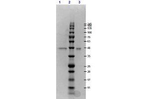 SDS-PAGE results of ERK1 double mutant recombinant Protein. (ERK1 Protein (double Mutant))
