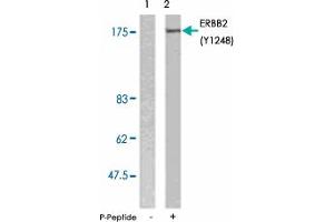 Western blot analysis of extracts from SK-OV-3 cells using ERBB2 (phospho Y1248) polyclonal antibody . (ErbB2/Her2 antibody  (pTyr1248))
