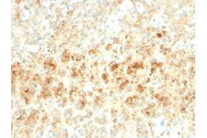 Formalin-fixed, paraffin-embedded human Adrenal Gland stained with Adipophilin Recombinant Rabbit Monoclonal Antibody (ADFP/2755R). (Recombinant ADRP antibody  (AA 249-376))