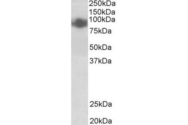 PRDM1 antibody  (Internal Region)