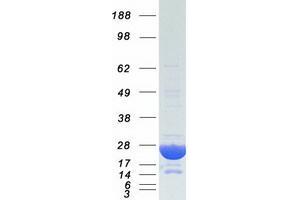Validation with Western Blot (CRYAB Protein (Myc-DYKDDDDK Tag))