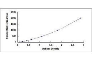 Aminoacyl tRNA Synthetase Complex-Interacting Multifunctional Protein 1 (AIMP1) ELISA Kit