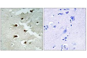 Immunohistochemistry analysis of paraffin-embedded human brain tissue using CDCA4 antibody. (CDCA4 antibody  (Internal Region))