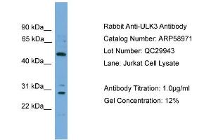 WB Suggested Anti-ULK3  Antibody Titration: 0. (ULK3 antibody  (Middle Region))
