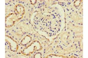Immunohistochemistry of paraffin-embedded human kidney tissue using ABIN7146119 at dilution of 1:100 (CXCL11 antibody  (AA 22-94))