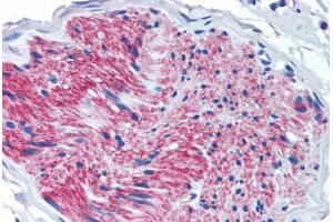 Anti-P2RX7 / P2X7 antibody  ABIN1049197 IHC staining of human pancreas, nerve. (P2RX7 antibody  (Internal Region))