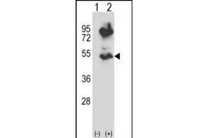 Western blot analysis of HTRA2 (arrow) using rabbit polyclonal HTRA2 Antibody (N-term) (ABIN657628 and ABIN2846624). (HTRA2 antibody  (N-Term))