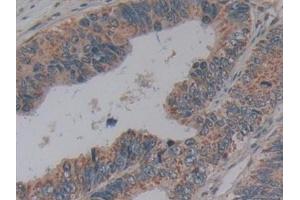 Immunohistochemistry (IHC) image for anti-Microfibrillar Associated Protein 2 (MFAP2) (AA 6-162) antibody (ABIN7442855)