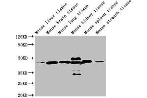 Western Blot Positive WB detected in: Mouse liver tissue, Mouse brain tissue, Mouse lung tissue, Mouse kidney tissue, Mouse spleen tissue, Mouse stomach tissue All lanes: ACTB antibody at 1:5000 Secondary Goat polyclonal to mouse IgG at 1/50000 dilution Predicted band size: 42 KDa Observed band size: 42 KDa Exposure time: 5 min (beta Actin antibody  (AA 1-50))