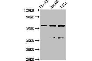 Western Blot Positive WB detected in: HL-60 whole cell lysate, HepG2 whole cell lysate, U251 whole cell lysate All lanes: ENTPD1 antibody at 2. (CD39 antibody  (AA 316-474))