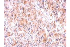 IHC-P Image Immunohistochemical analysis of paraffin-embedded U373 xenograft, using GSTM1, antibody at 1:500 dilution. (GSTM1 antibody  (C-Term))