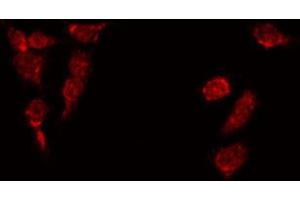 ABIN6269272 staining HepG2 by IF/ICC. (CEBPA antibody  (N-Term))