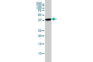 CAPG monoclonal antibody (M01), clone 1F1 Western Blot analysis of CAPG expression in HL-60 . (CAPG antibody  (AA 1-348))