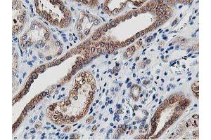 Image no. 8 for anti-Leucine Carboxyl Methyltransferase 1 (LCMT1) antibody (ABIN1499107) (LCMT1 antibody)