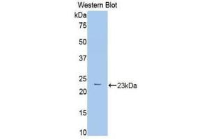 Western Blotting (WB) image for anti-phosphorylase, Glycogen, Liver (PYGL) (AA 370-538) antibody (ABIN1860383) (PYGL antibody  (AA 370-538))