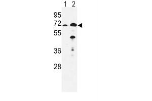 Western Blotting (WB) image for anti-Enoyl-CoA, Hydratase/3-Hydroxyacyl CoA Dehydrogenase (EHHADH) antibody (ABIN3003844) (EHHADH antibody)