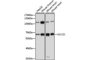 Western blot analysis of extracts of various cell lines, using GLCCI1 antibody (ABIN7267395) at 1000 dilution. (GLCCI1 antibody  (AA 120-230))