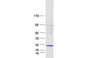 Validation with Western Blot (WW Domain Binding Protein 5 (WBP5) (Transcript Variant 1) protein (Myc-DYKDDDDK Tag))