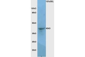 Mouse lung lysates probed with Rabbit Anti-LAMP-1 Polyclonal Antibody, Unconjugated  at 1:3000 for 90 min at 37˚C.