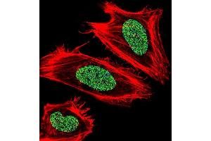 Fluorescent confocal image of Hela cell stained with UHRF1 Antibody (Center) (ABIN652792 and ABIN2842520). (UHRF1 antibody  (AA 229-257))