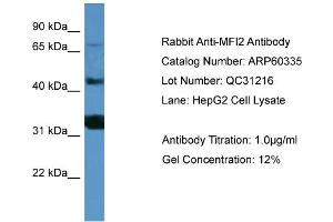 WB Suggested Anti-MFI2  Antibody Titration: 0. (MFI2 antibody  (C-Term))