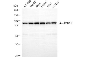 anti-Karyopherin (Importin) beta 1 (KPNB1) antibody