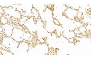 Detection of GAL3 in Human Lung Tissue using Monoclonal Antibody to Galectin 3 (GAL3) (Galectin 3 antibody  (AA 1-250))
