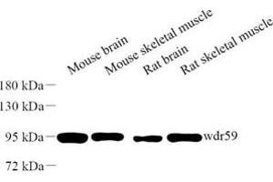 Western blot analysis of wdr59 (ABIN7076219) at dilution of 1: 500 (WDR59 antibody)