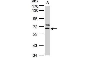 THUMPD3 antibody