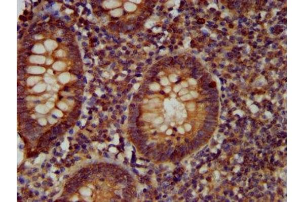 CDCA7L antibody  (AA 14-167)