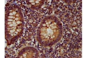 IHC image of ABIN7147311 diluted at 1:400 and staining in paraffin-embedded human appendix tissue performed on a Leica BondTM system.