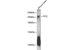 Western blot analysis of extracts of mouse heart, using TET2 antibody (ABIN6133018, ABIN6149016, ABIN6149018 and ABIN6216528) at 1:1000 dilution. (TET2 antibody  (AA 1833-2002))