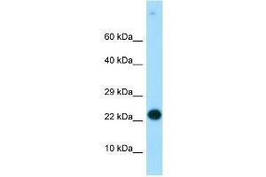 WB Suggested Anti-RGS19 Antibody Titration:  0. (RGS19 antibody  (N-Term))