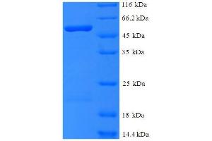 SDS-PAGE (SDS) image for PLY1 (AA 22-374) protein (His-SUMO Tag) (ABIN5710796) (PLY1 (AA 22-374) protein (His-SUMO Tag))