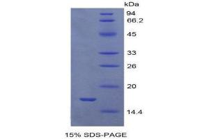 SDS-PAGE (SDS) image for Growth Differentiation Factor 9 (GDF9) (AA 320-454) protein (His tag) (ABIN1877732) (GDF9 Protein (AA 320-454) (His tag))