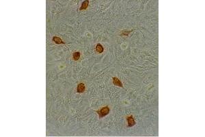 Immunohistochemical staining using MAb-Ad-H-1 antibody on Adenovirus AV2 infected Hela cells (Human Adenovirus Hexon (HAdV Hexon) antibody)