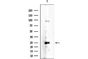 anti-B-Cell CLL/lymphoma 7C (BCL7C) (Internal Region) antibody