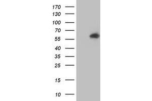 HEK293T cells were transfected with the pCMV6-ENTRY control (Left lane) or pCMV6-ENTRY AKT1 (Right lane) cDNA for 48 hrs and lysed. (AKT1 antibody)