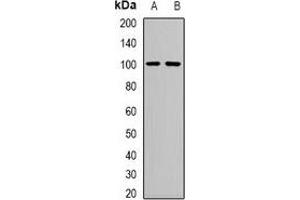 Western blot analysis of Neutral Ceramidase expression in mouse kidney (A), mouse heart (B) whole cell lysates. (ASAH2 antibody)