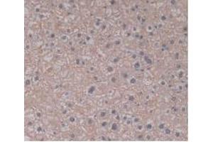 IHC-P analysis of Human Liver Tissue, with DAB staining. (TLR5 antibody  (AA 693-858))