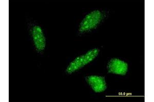 Immunofluorescence of monoclonal antibody to RNF24 on HeLa cell. (RNF24 antibody  (AA 49-148))